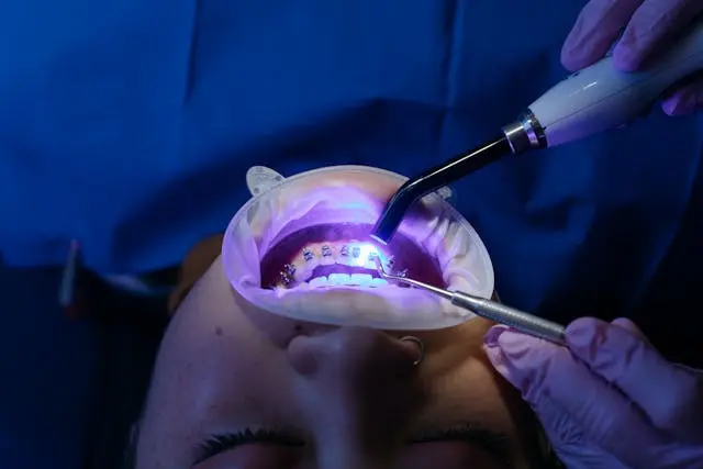 Teeth Whitening Methods