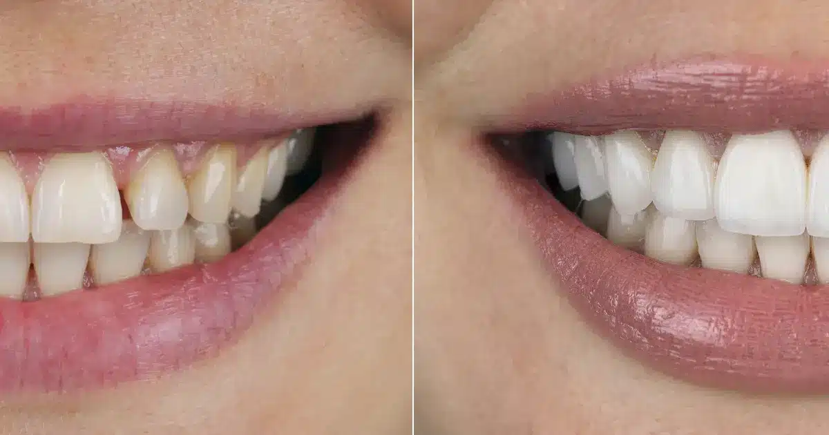 Finding Your Perfect Smile Solution