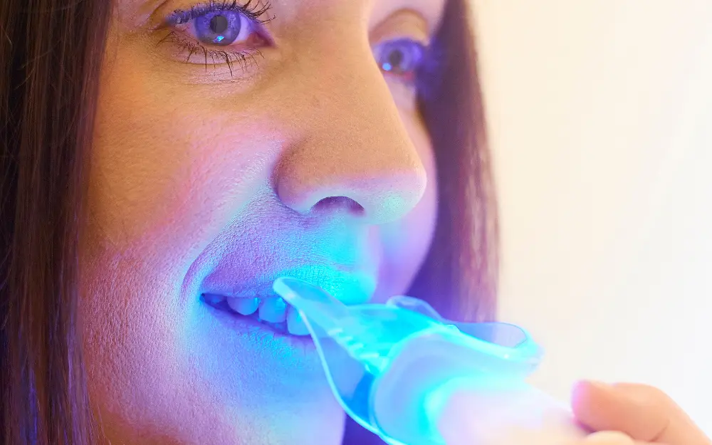 At-Home Whitening Kits